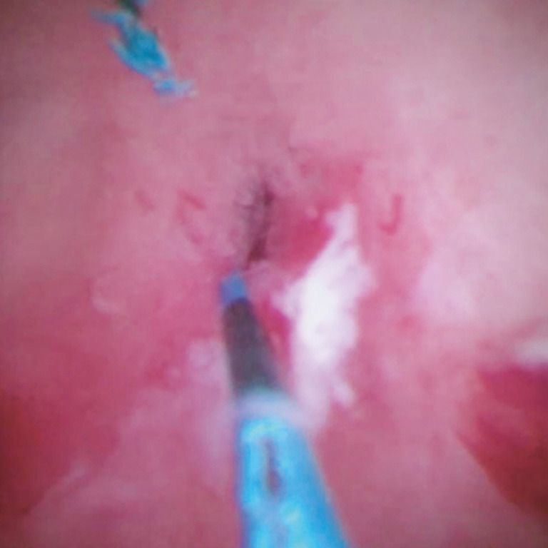 Fig. 4