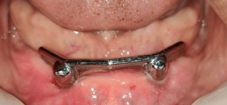 Figure 11