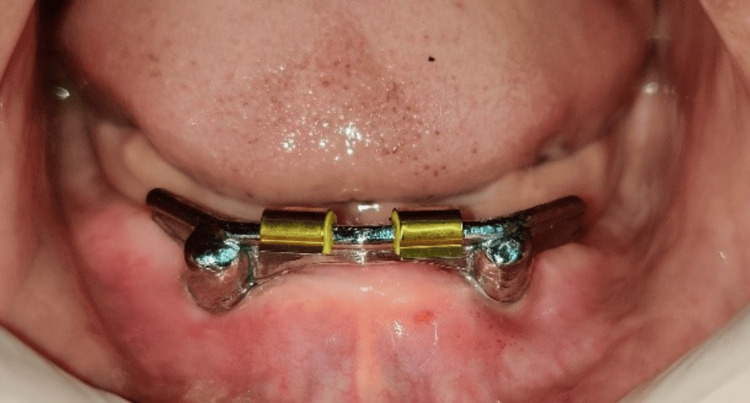 Figure 12