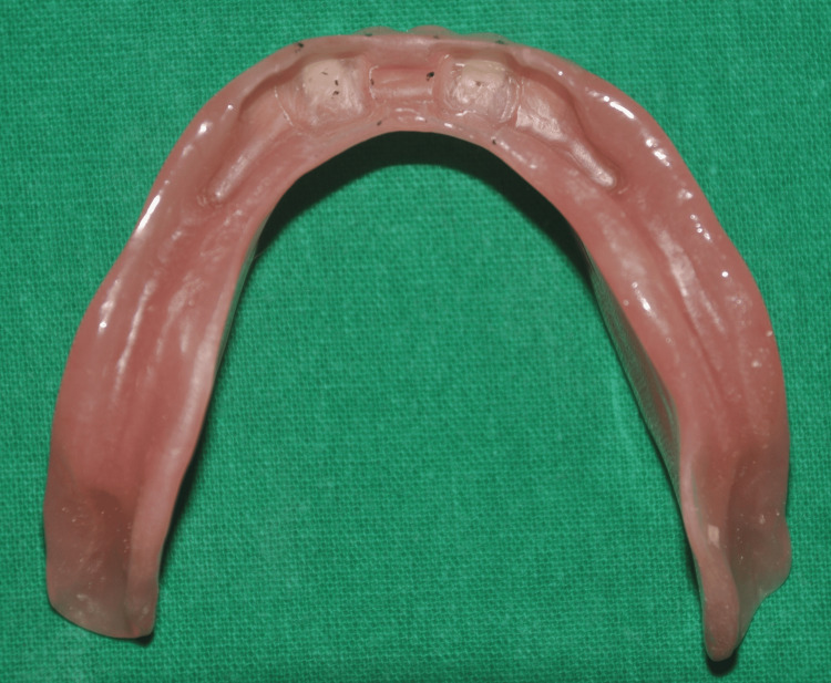 Figure 13