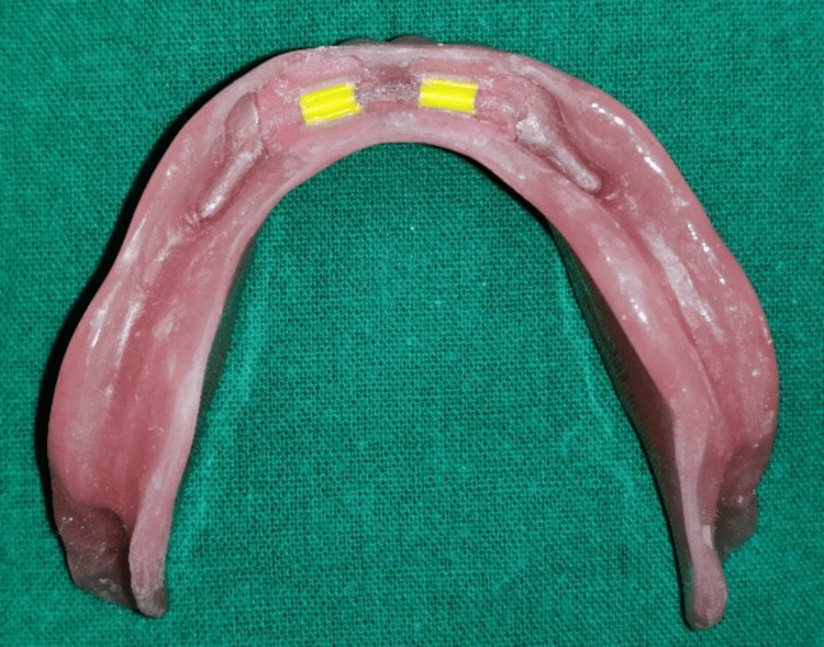 Figure 14
