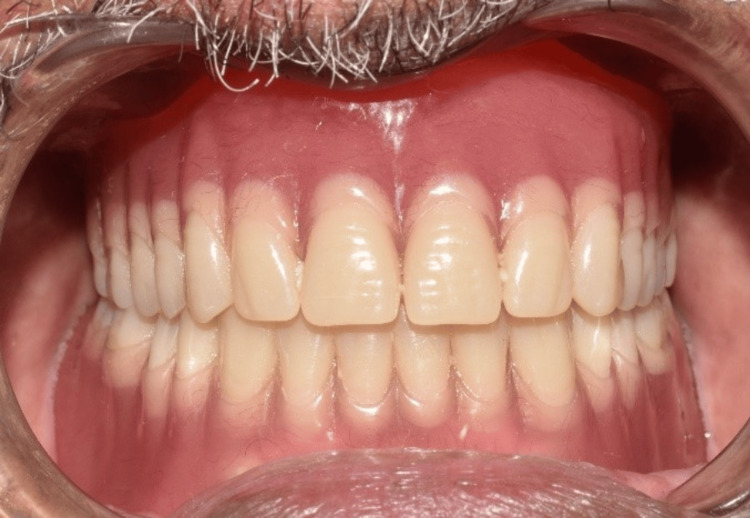 Figure 15