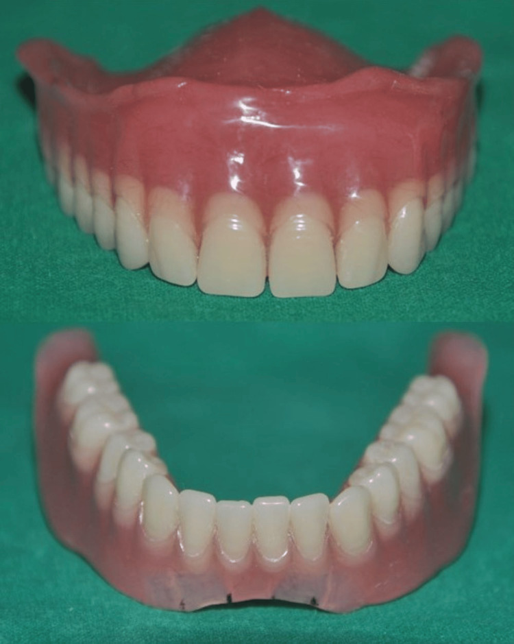 Figure 17
