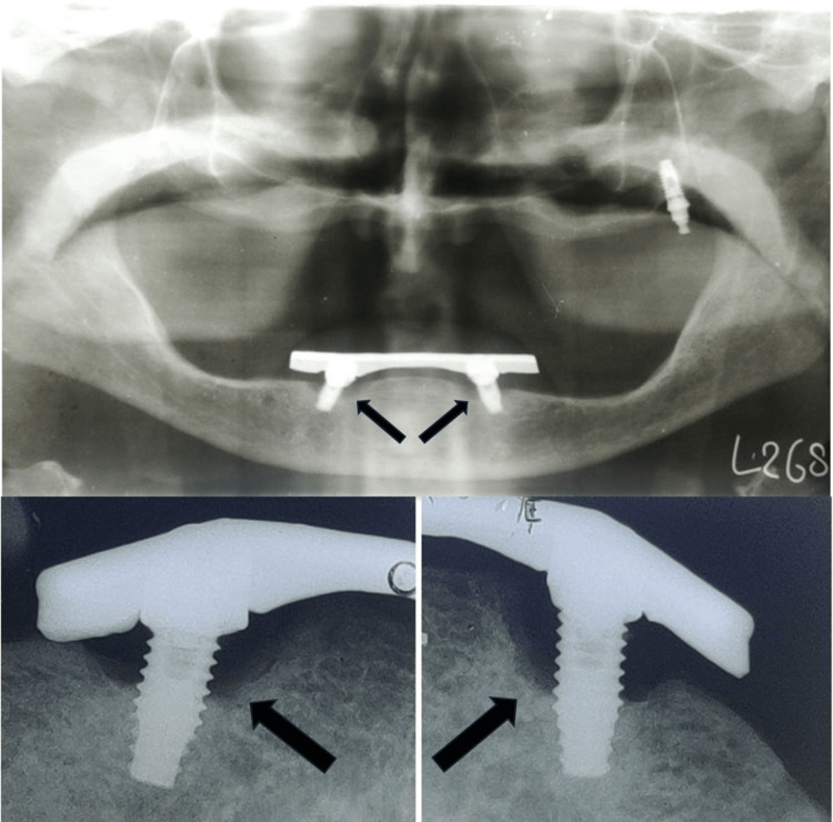 Figure 18