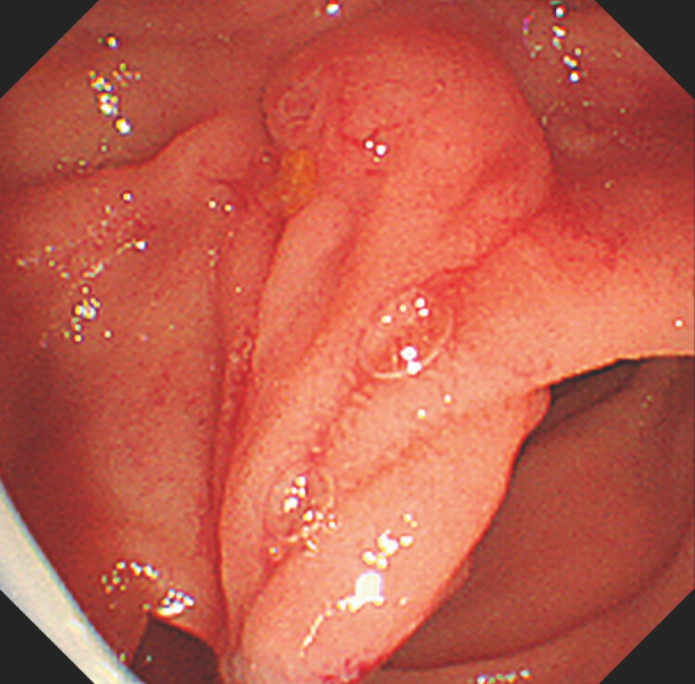 Fig. 2