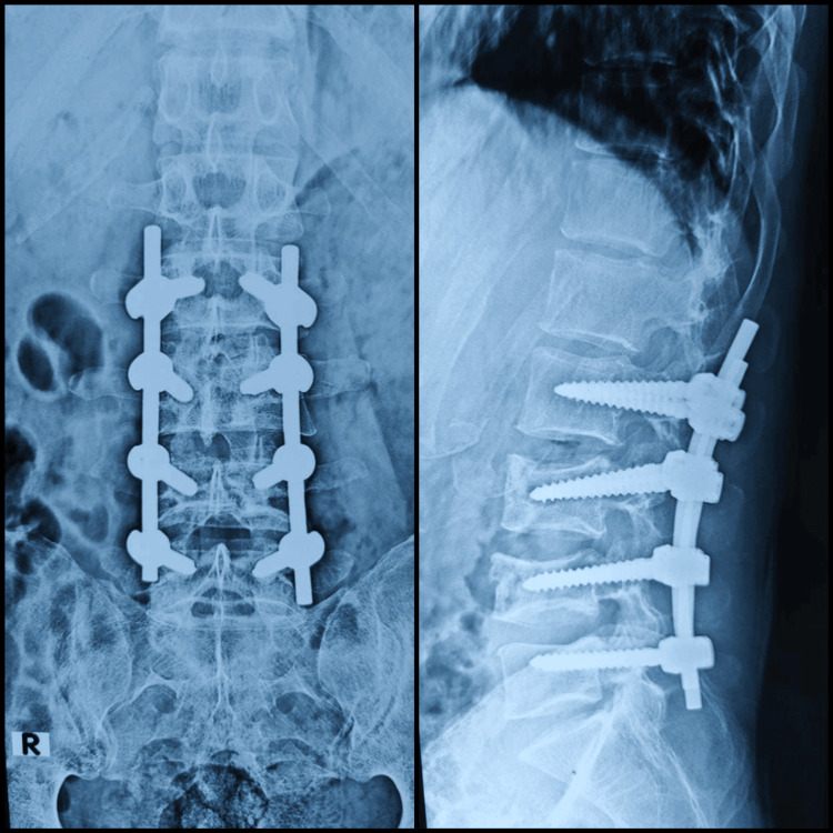 Figure 11