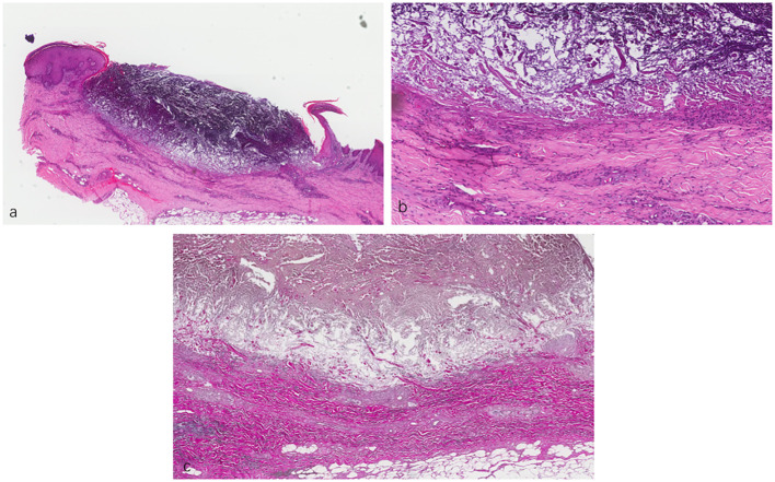 Figure 2