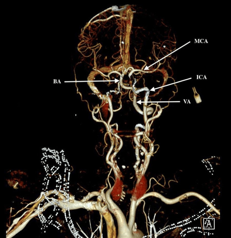 Figure 2