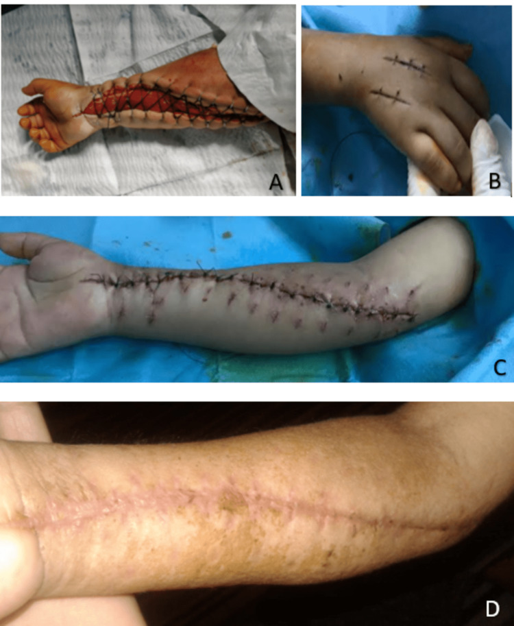 Figure 6