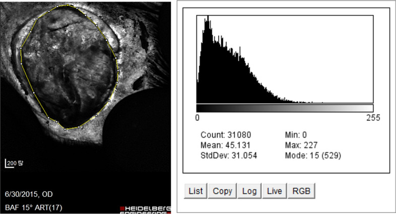 Figure 12