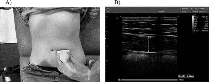 Fig 2