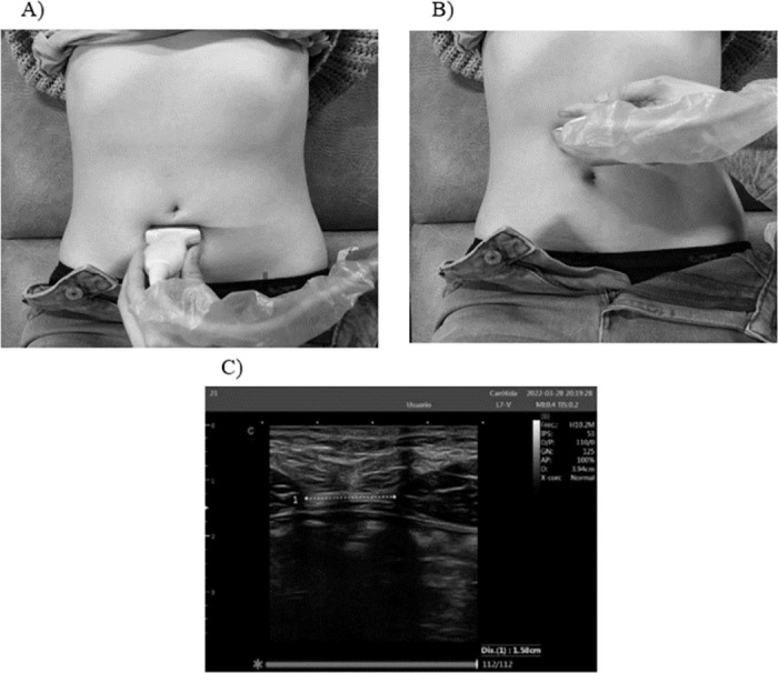 Fig 3