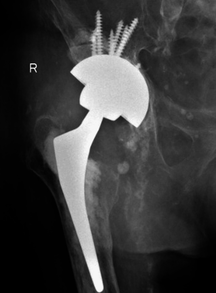 Figure 9