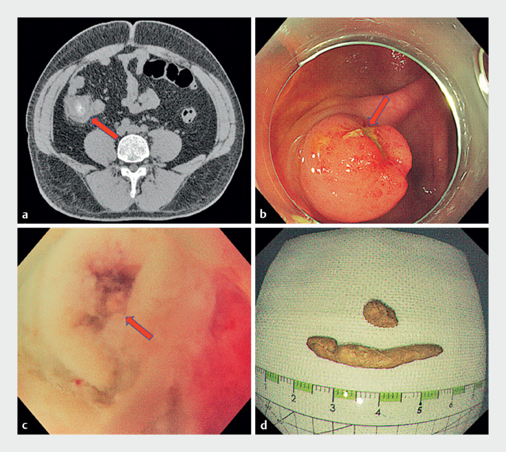 Fig. 1