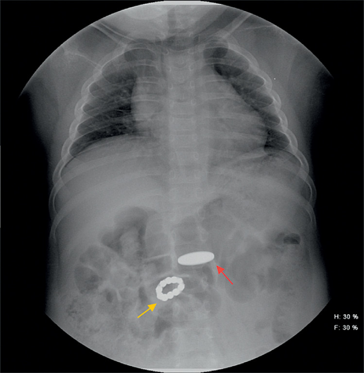 Fig. 1