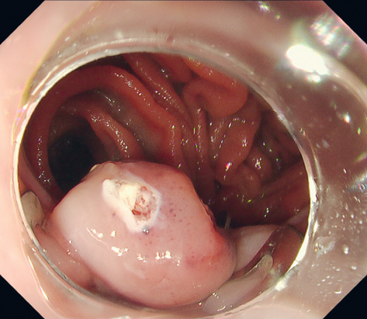 Fig. 3