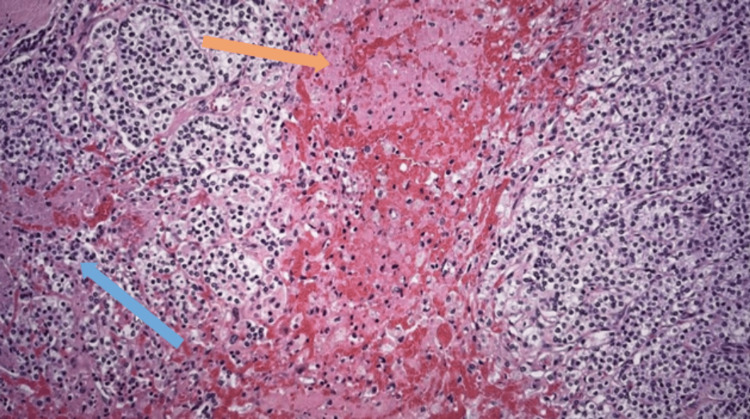 Figure 9