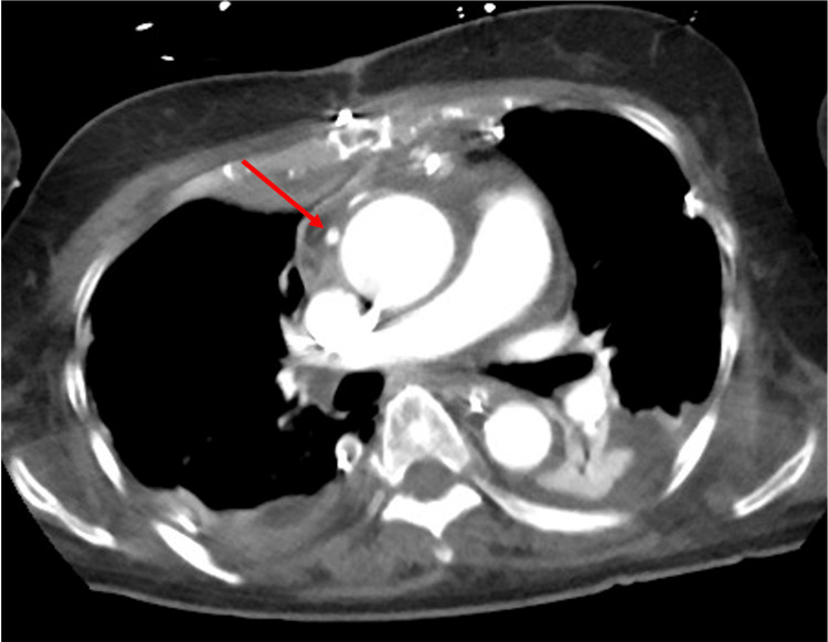 Figure 6