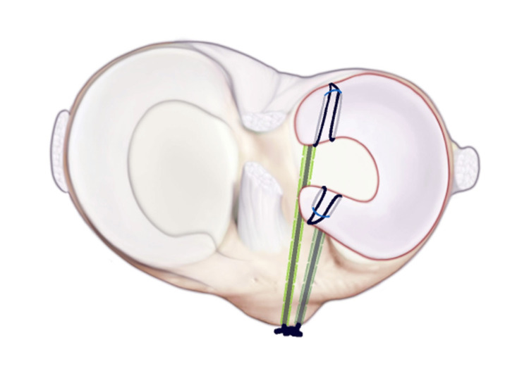 Figure 9