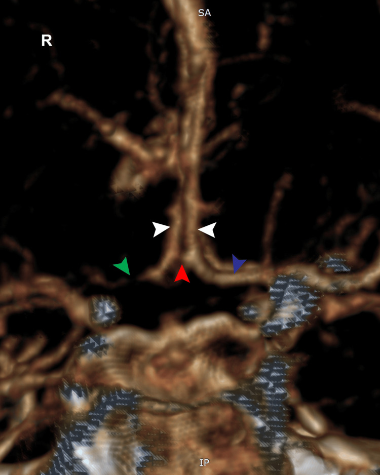 Figure 5