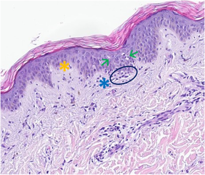 FIGURE 3