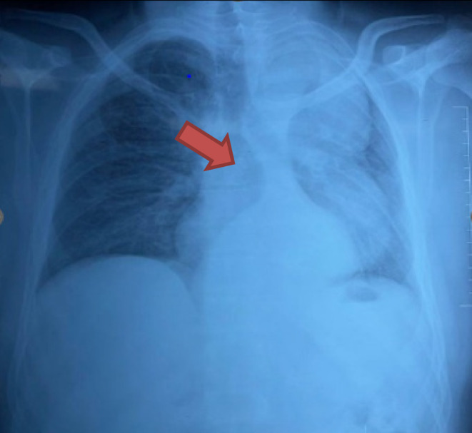FIGURE 1