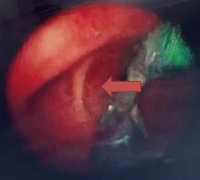 FIGURE 3