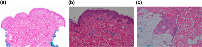 FIGURE 3