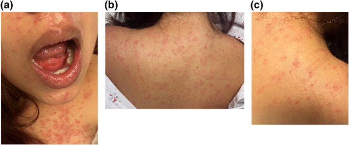 FIGURE 1