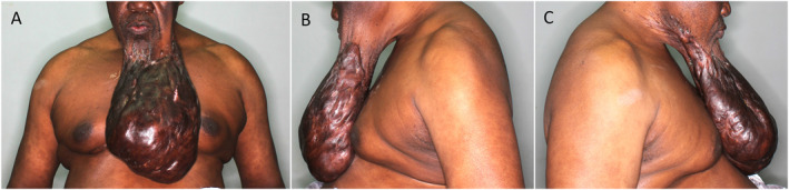 FIGURE 1
