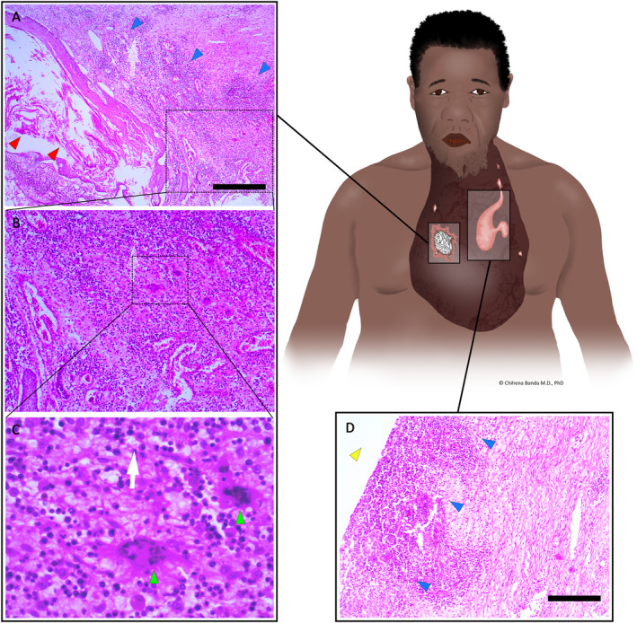 FIGURE 2