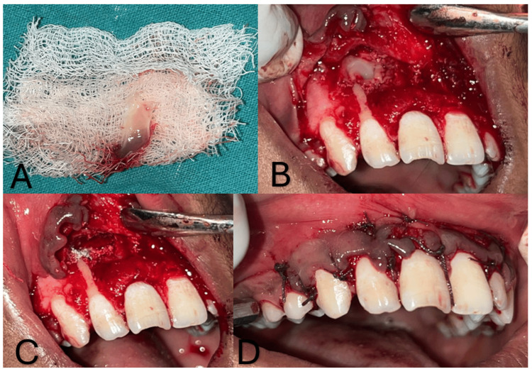 Figure 4