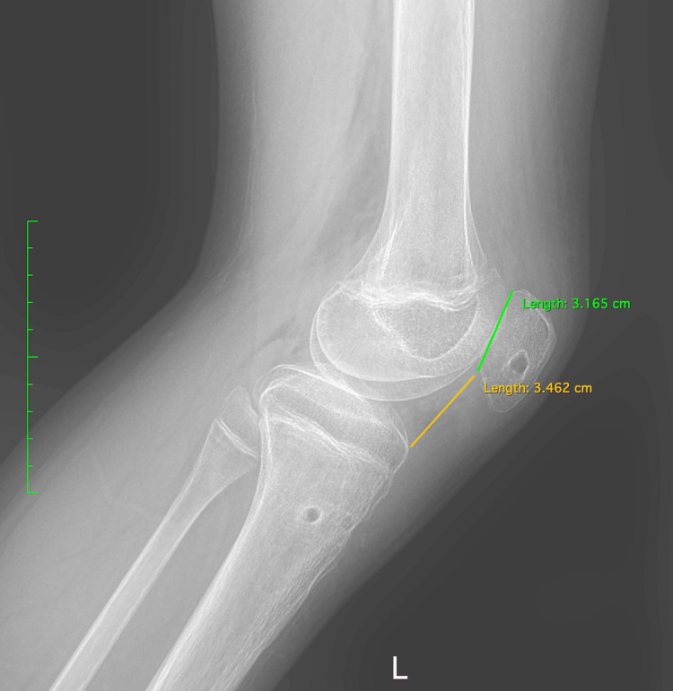 Figure 12