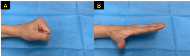 Figure 11