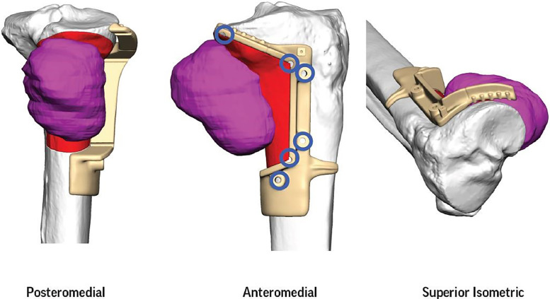 Figure 10