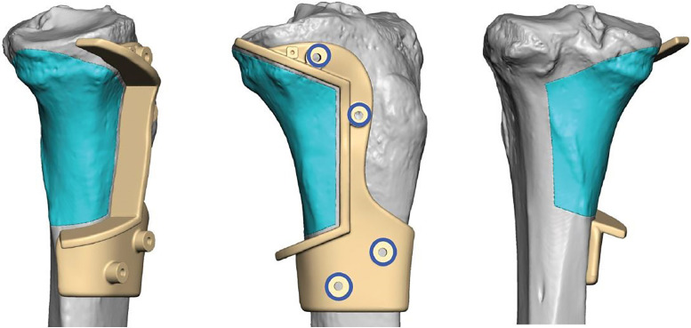 Figure 11