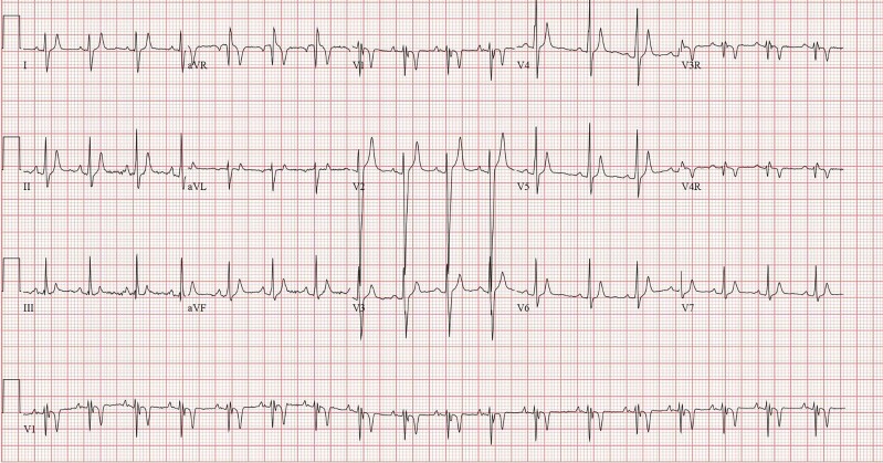 Figure 1