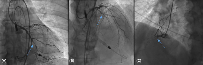 FIGURE 1