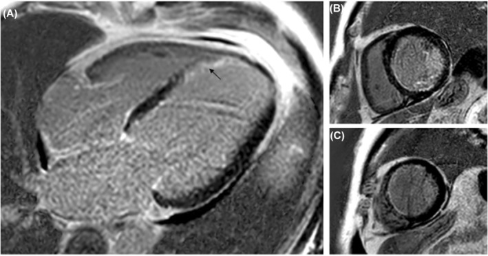 FIGURE 2