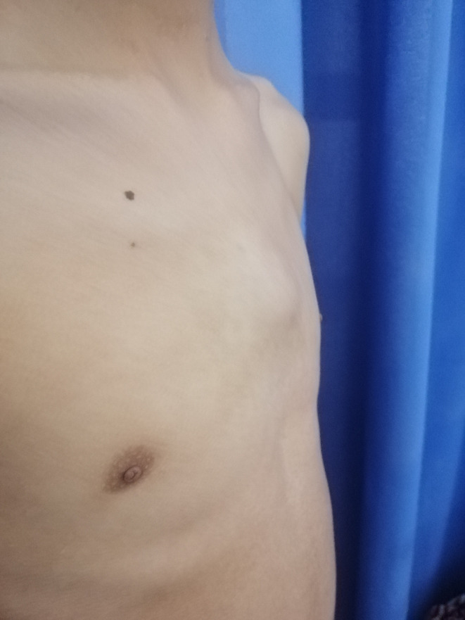 Fig. 1