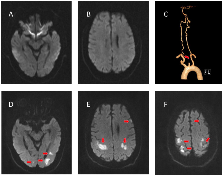 Figure 3