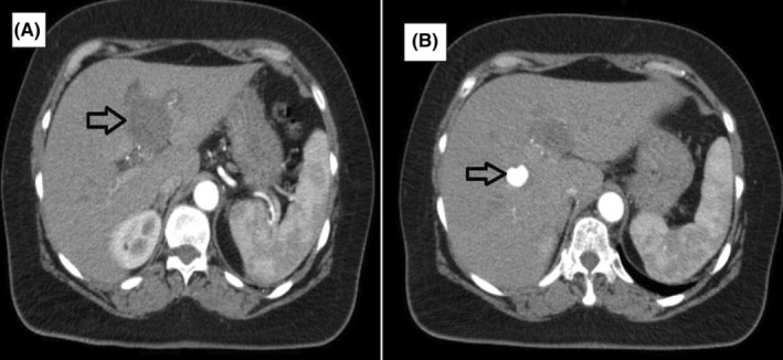 FIGURE 2