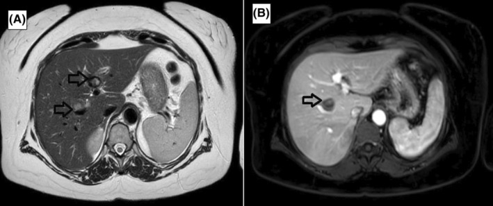 FIGURE 3