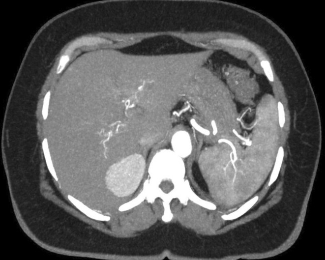 FIGURE 4