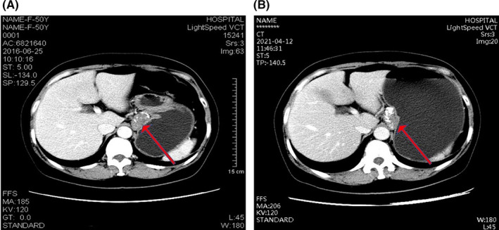 FIGURE 2