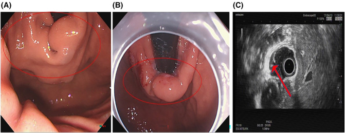 FIGURE 1