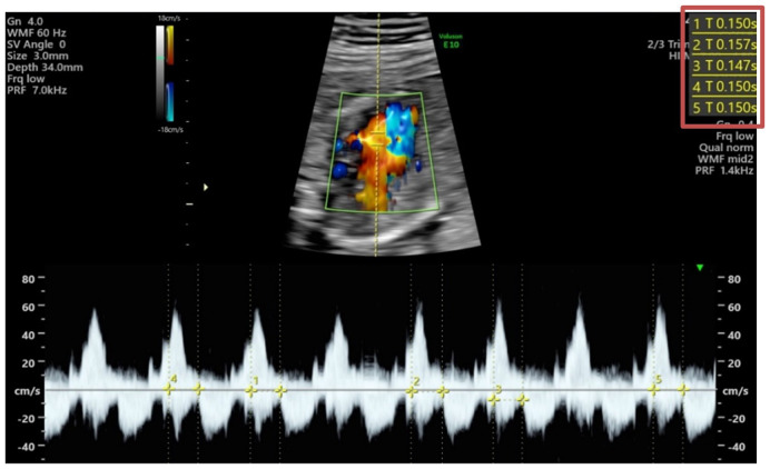 Figure 1