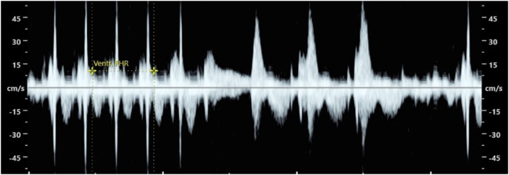 Figure 2
