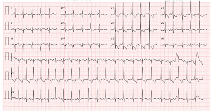 Figure 3