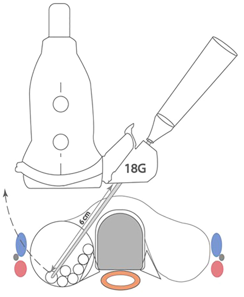 Figure 1